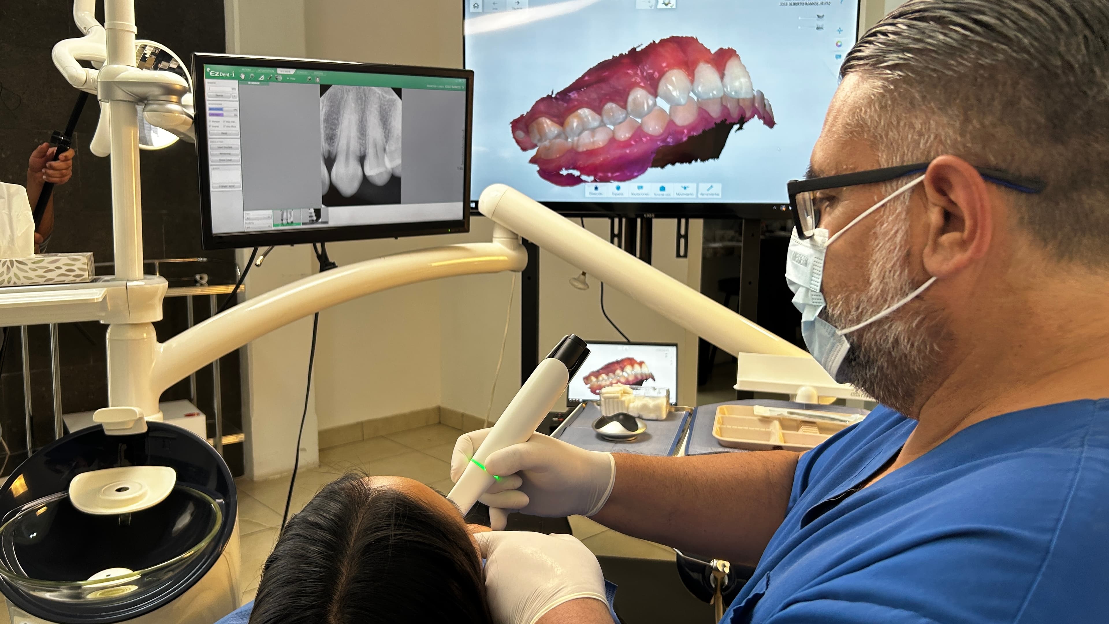 Escaneo intraoral TRIOS