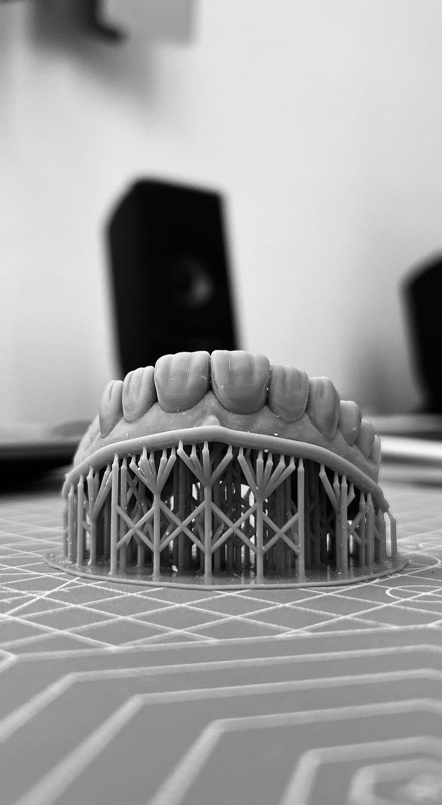 Impresión 3D dental